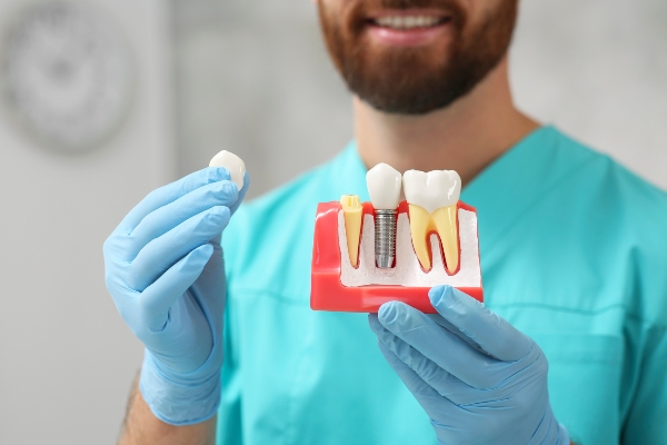 Dental Implants: A Solution For Missing Teeth